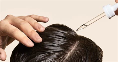 Topical Hair Loss Treatment .